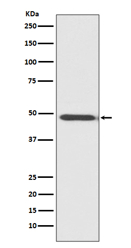 WB - Anti-MyoD1/Myod Rabbit Monoclonal Antibody ABO13762